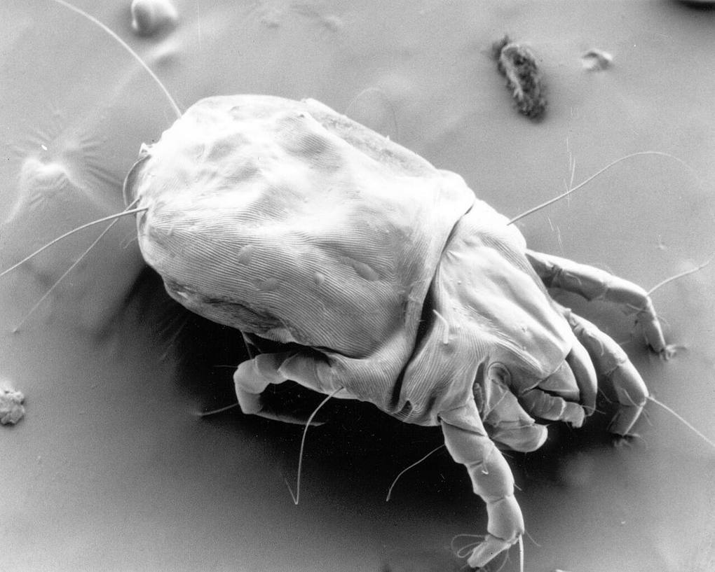 A female house dust mite magnified in a scanning electron micrograph