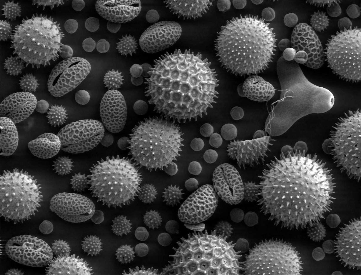 A variety of pollen grains magnified under a microscope